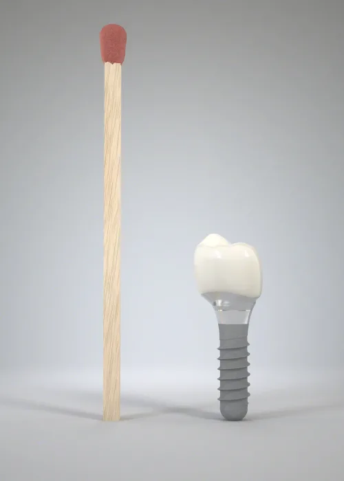 A single straumann  dental implant and porcelain crown standing next to a wooden matchstick to illustrate its small size and scale.