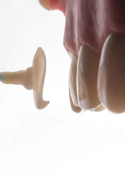 Close-up of a custom-fabricated CEREC crown held next to a prepped tooth for final shade and fit check.