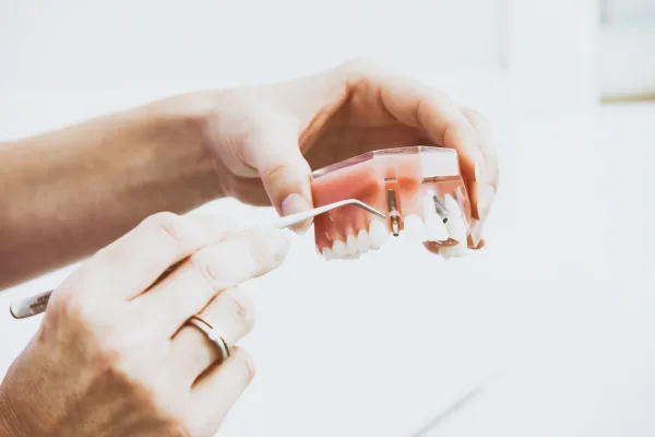 Gloved hands holding a dental implant model to explain the tooth replacement process.