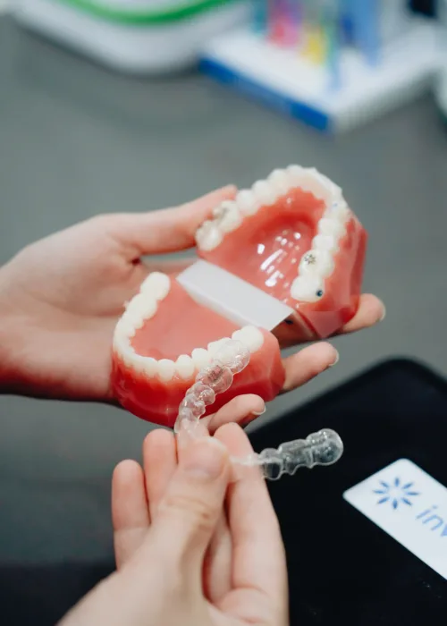 Hands demonstrating how a custom clear aligner tray fits over a dental teeth model.